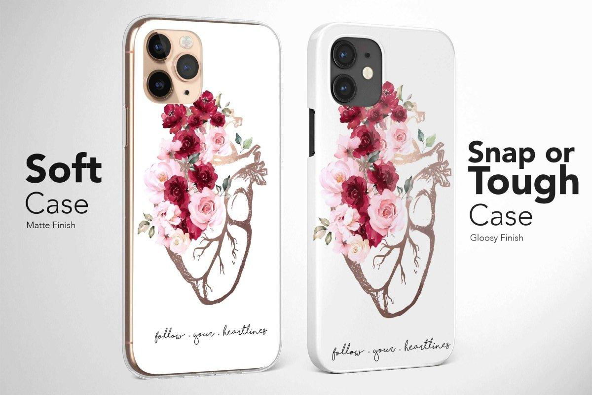 Nurse Phone Case, Anatomy Phone Case, Aesthetic Phone Case, Hospital Phone Case 1 - Image 2