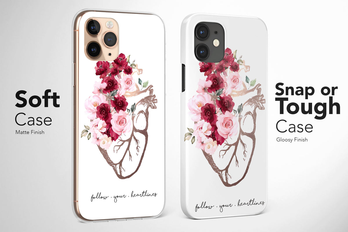 Nurse Phone Case, Anatomy Phone Case, Aesthetic Phone Case, Hospital Phone Case - Image 2