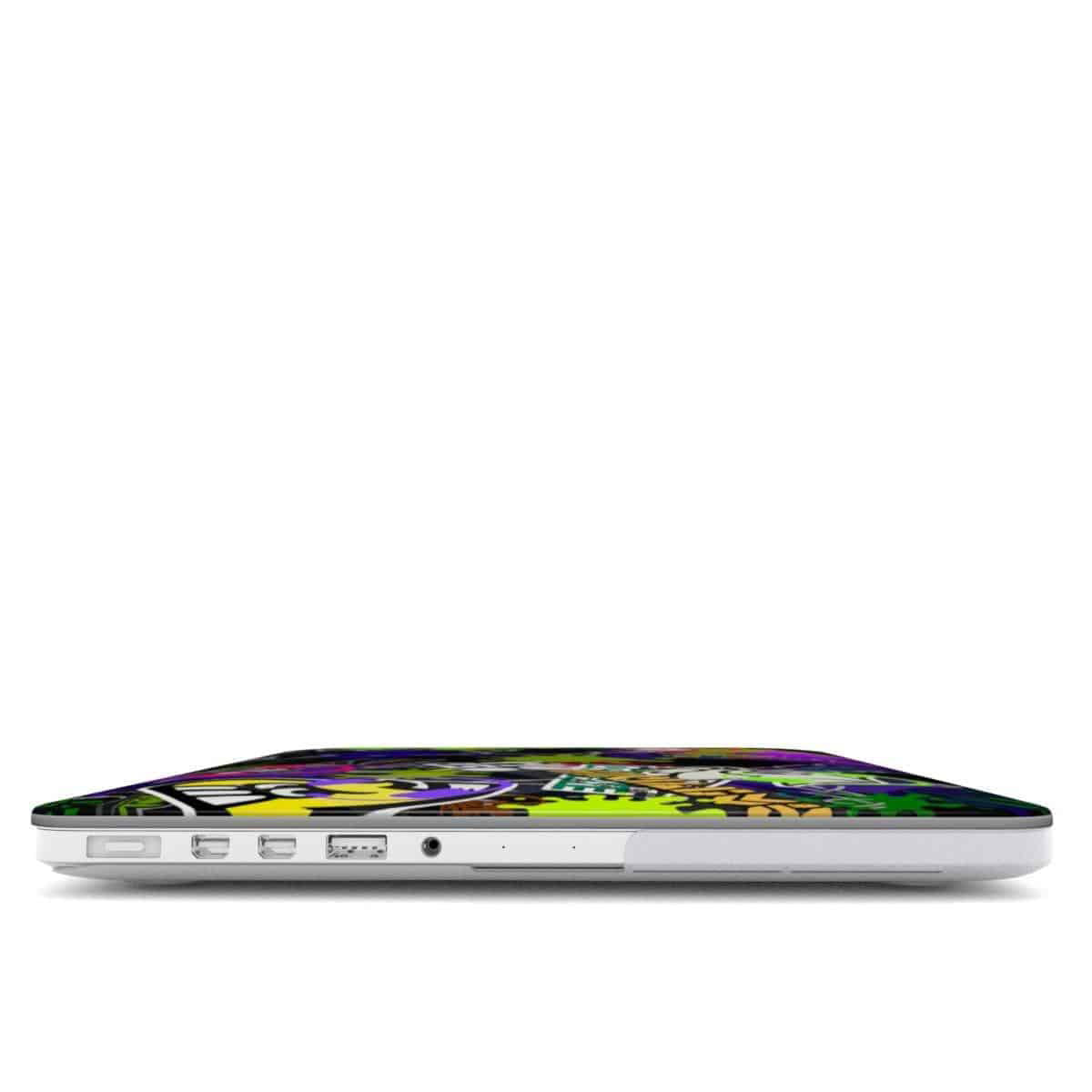 Splatoon Macbook Case Cartoon Kid Game Cover - Image 2